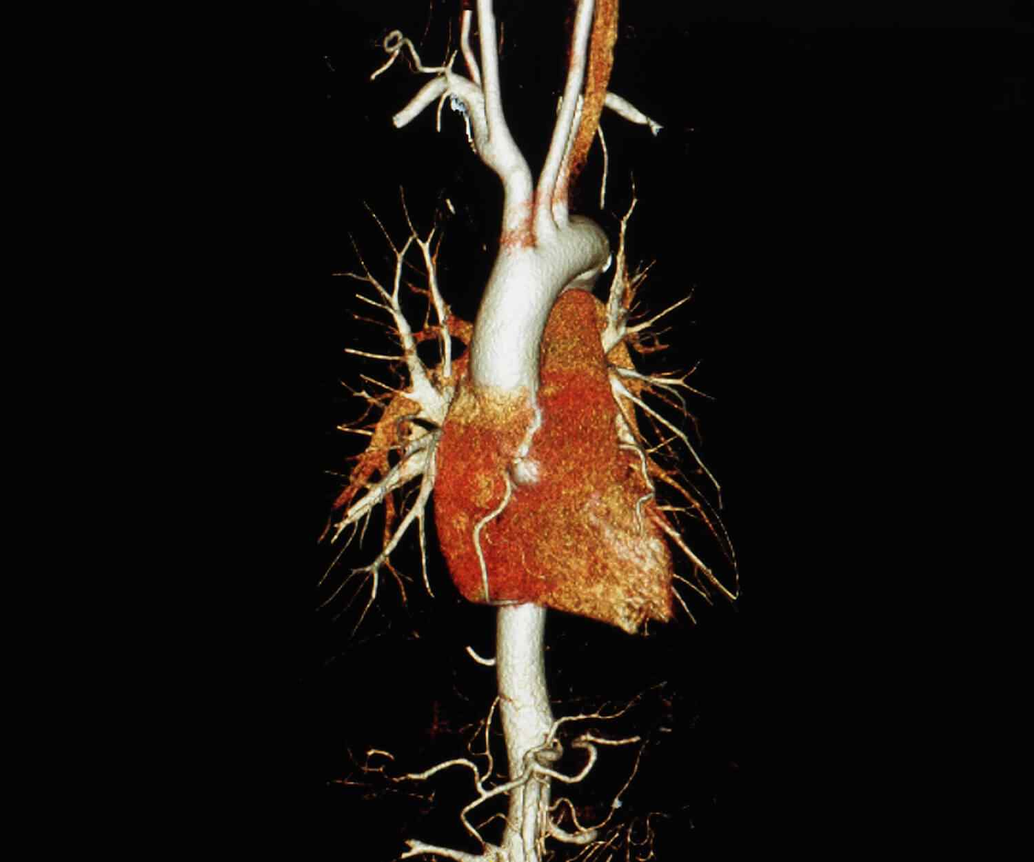 https://apollohosp.co.in/wp-content/uploads/2021/09/card_image_10.jpg