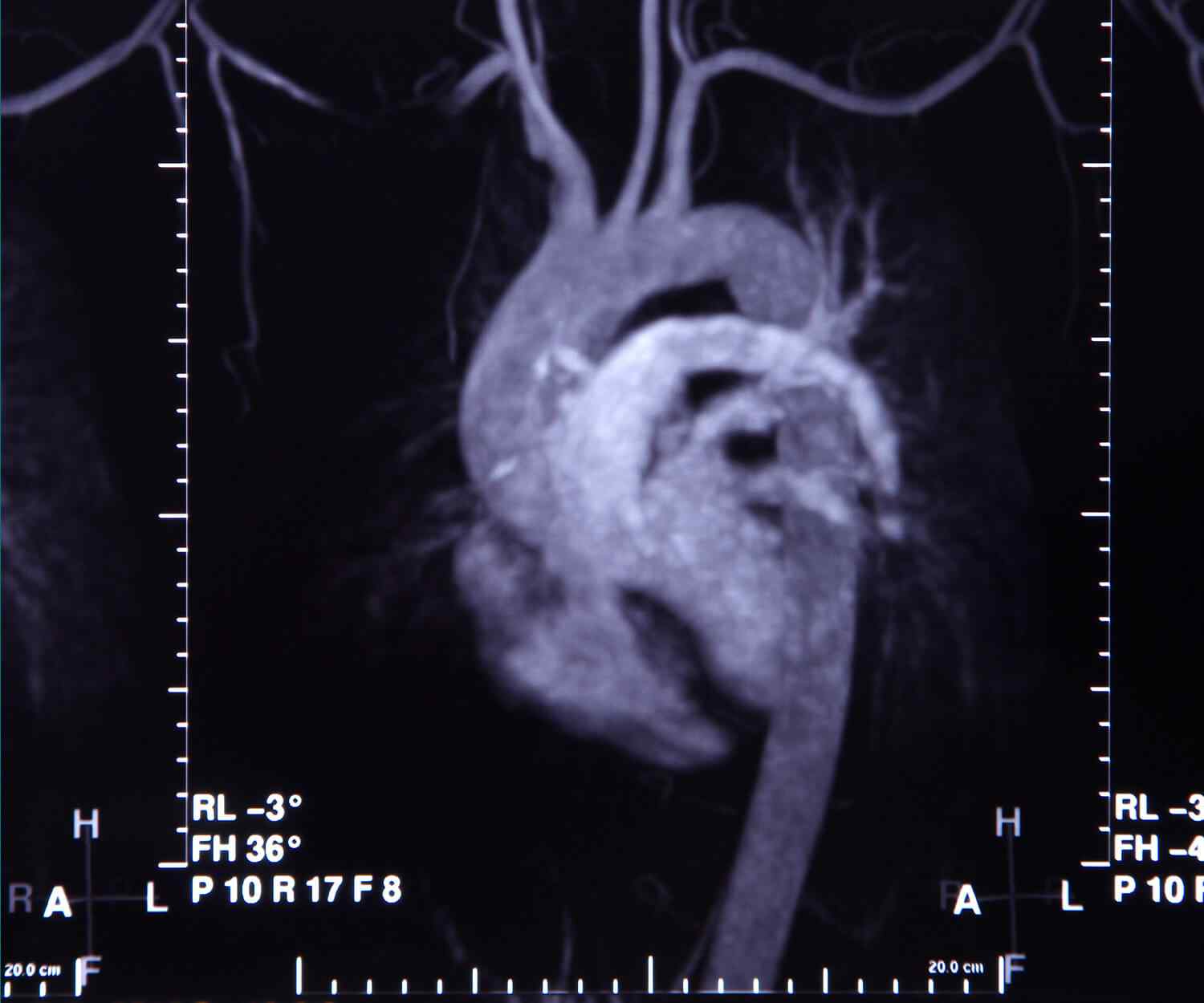 https://apollohosp.co.in/wp-content/uploads/2021/09/card_image_11.jpg