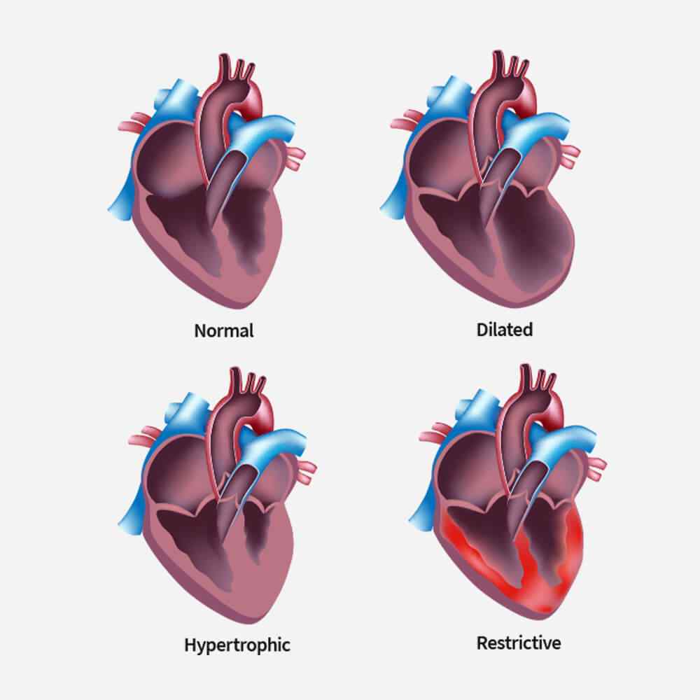 single_service_02 https://apollohosp.co.in/wp-content/uploads/2021/09/single_service_02.jpg